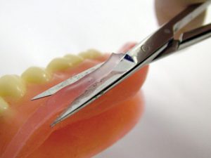 Trim EasySoft with sharp scissors/scalpel.